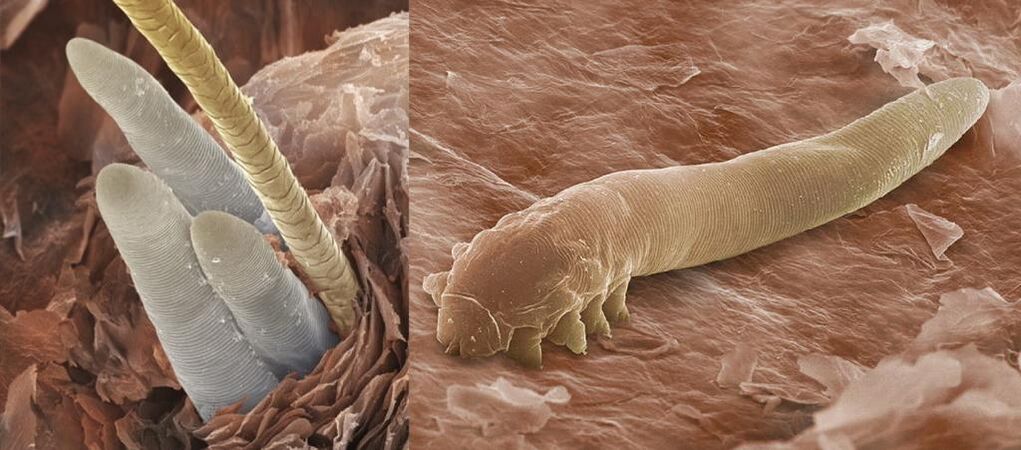 Ectoparasiti