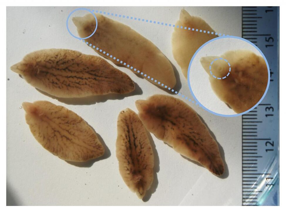 Trematodi epatici