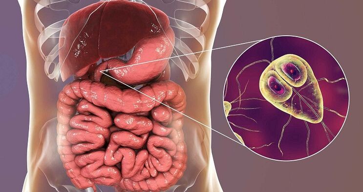 parassiti nel trattamento del corpo con rimedi popolari