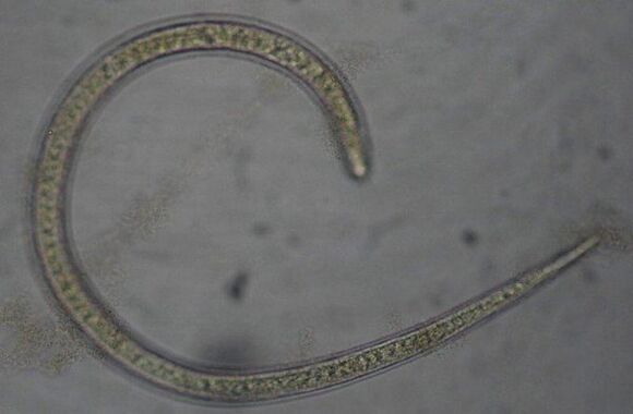 Trichinella è un verme parassita rotondo protostomico