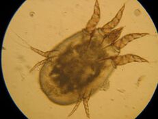 Spuntare al microscopio