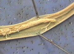 parassita